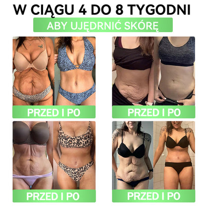✈️𝐀𝐍𝐆𝐄𝐋𝐓𝐑𝐀𝐏® 𝐌𝐨𝐫𝐢𝐧𝐠𝐚 × 𝐁𝐞𝐫𝐛𝐞𝐫𝐲𝐧𝐚 × 𝐀𝐌𝐏𝐊 𝟏𝟎-𝐰-𝟏 𝐖𝐬𝐩𝐚𝐫𝐜𝐢𝐞 𝐦𝐞𝐭𝐚𝐛𝐨𝐥𝐢𝐜𝐳𝐧𝐞, 𝐩𝐥𝐚𝐬𝐭𝐞𝐫 𝐳 𝐧𝐚𝐧𝐨𝐭𝐞𝐜𝐡𝐧𝐨𝐥𝐨𝐠𝐢ą 𝐦𝐢𝐤𝐫𝐨𝐢𝐠ł𝐨𝐰ą 🇵🇱(Wystarczy raz dziennie, widoczne efekty w 7 dni) ✅ Na otyłość, wiotką skórę, cukrzycę, bezdech senny, problemy ze stawami i wiele innych